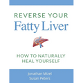 Reverse Your Fatty Liver: How To Naturally Heal Yourself - Paperback