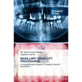 Maxillary Sinus Lift Procedures - Paperback
