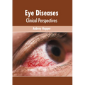 Eye Diseases: Clinical Perspectives - Hardcover