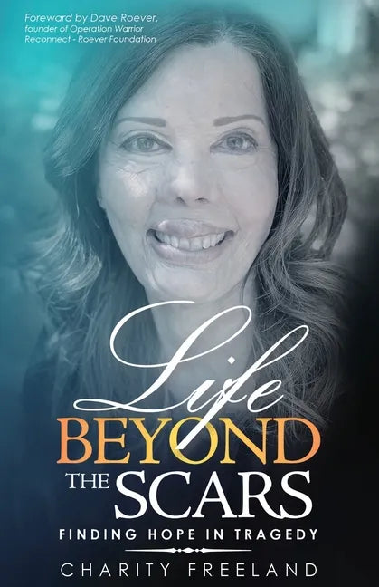 Life Beyond the Scars: Finding Hope in Tragedy - Paperback