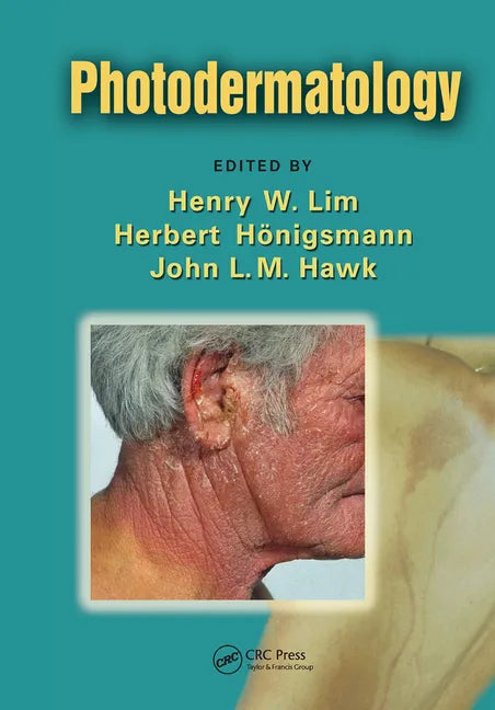 Photodermatology - Paperback