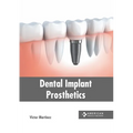 Dental Implant Prosthetics - Hardcover