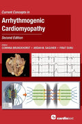 Current Concepts in Arrhythmogenic Cardiomyopathy, Second Edition - Hardcover