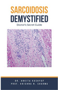 Sarcoidosis Demystified: Doctor's Secret Guide - Paperback
