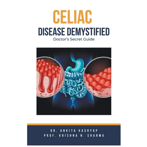 Celiac Disease Demystified: Doctor's Secret Guide - Paperback