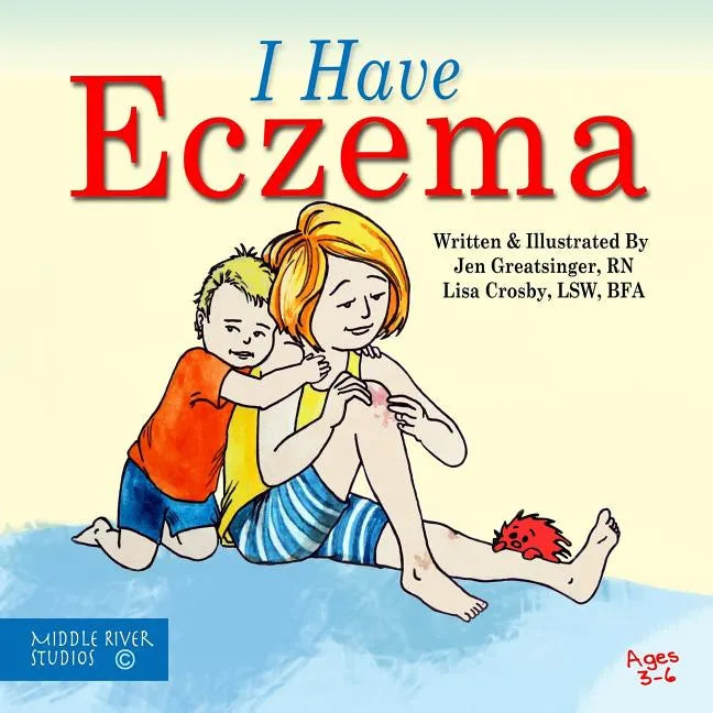 I Have Eczema - Paperback