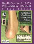 Physiotherapy Treatment Illustrated For Flat Feet (Pes Planus) Foot & Ankle Problems - Paperback