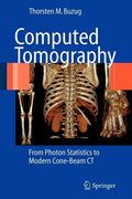 Computed Tomography: From Photon Statistics to Modern Cone-Beam CT - Paperback